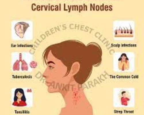 What Triggers Lymph Nodes to Swell